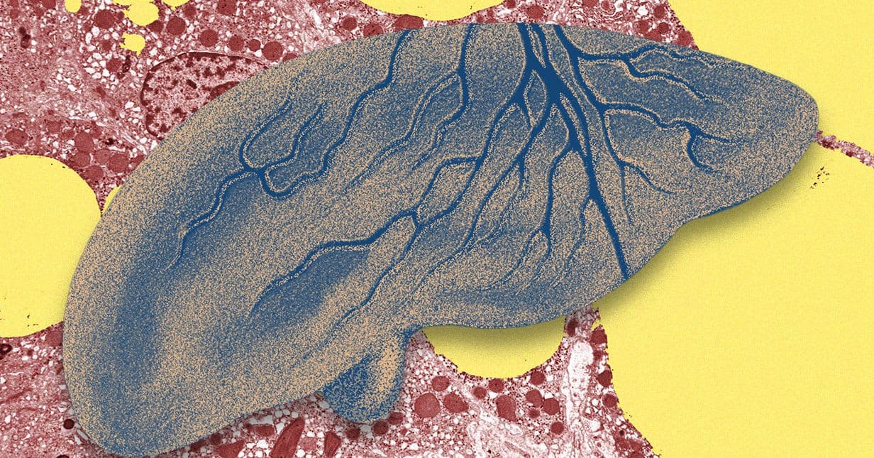 Combatting the Fatty Liver Epidemic with AI Technology | AOODAX